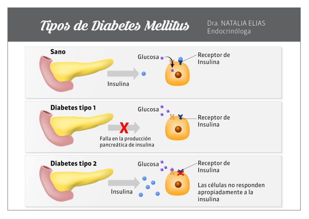 tipos de diabetes