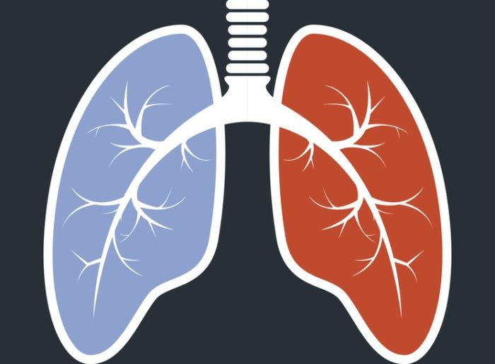 ¿Cómo causa el VIH la hipertensión pulmonar?