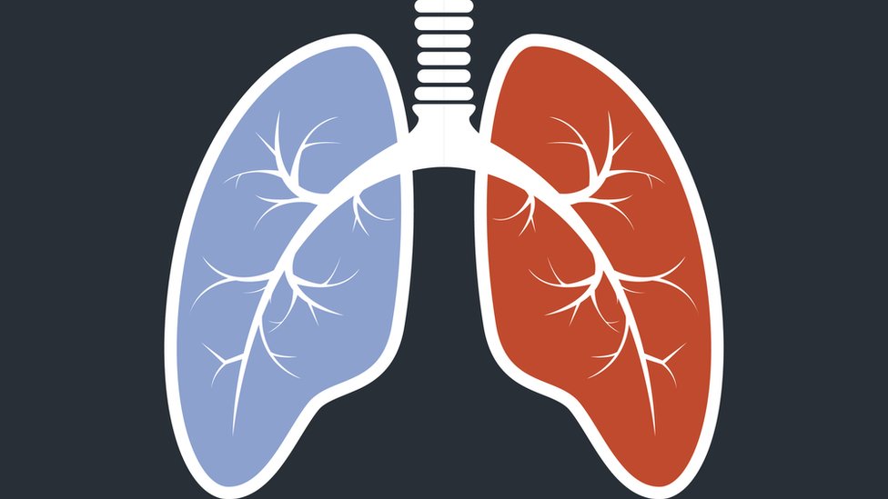 Hipertensión Arterial Pulmonar causada por HIV: ¿Qué es y..